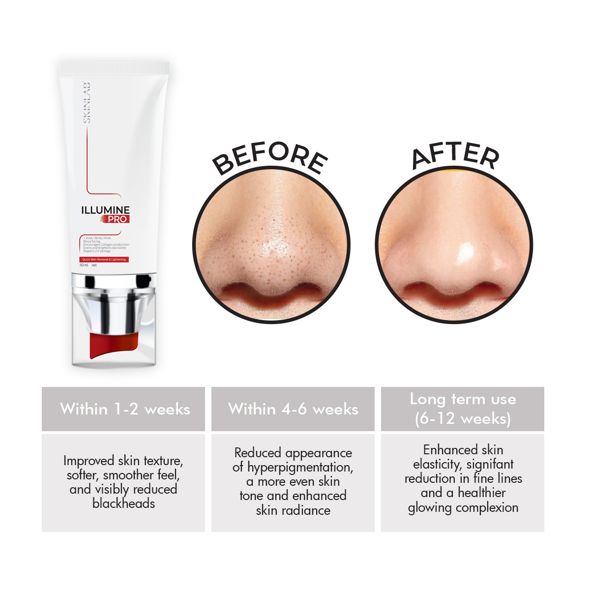 peel serum for acne, dark spots, and fine lines