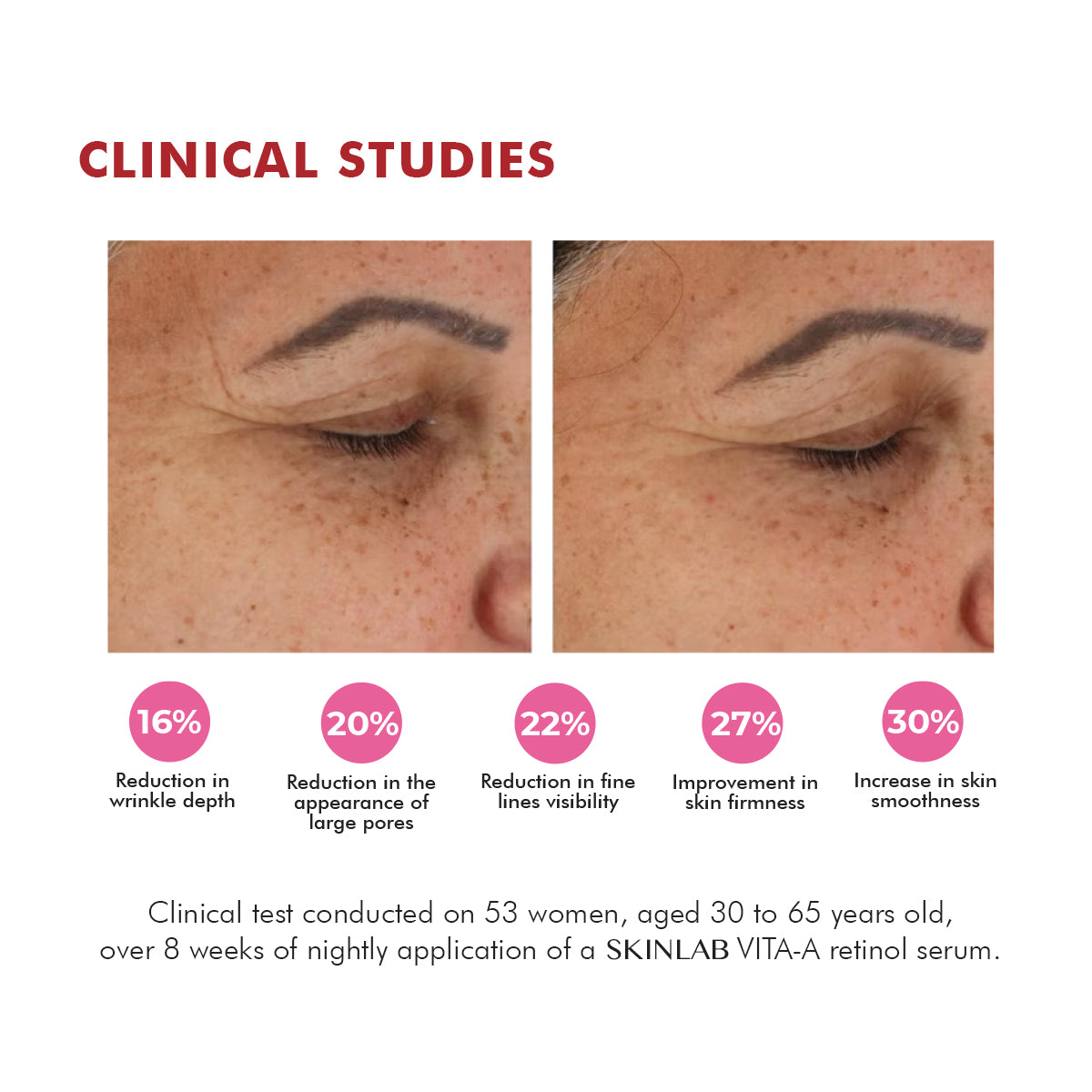 skinlab vita-a clinical studies