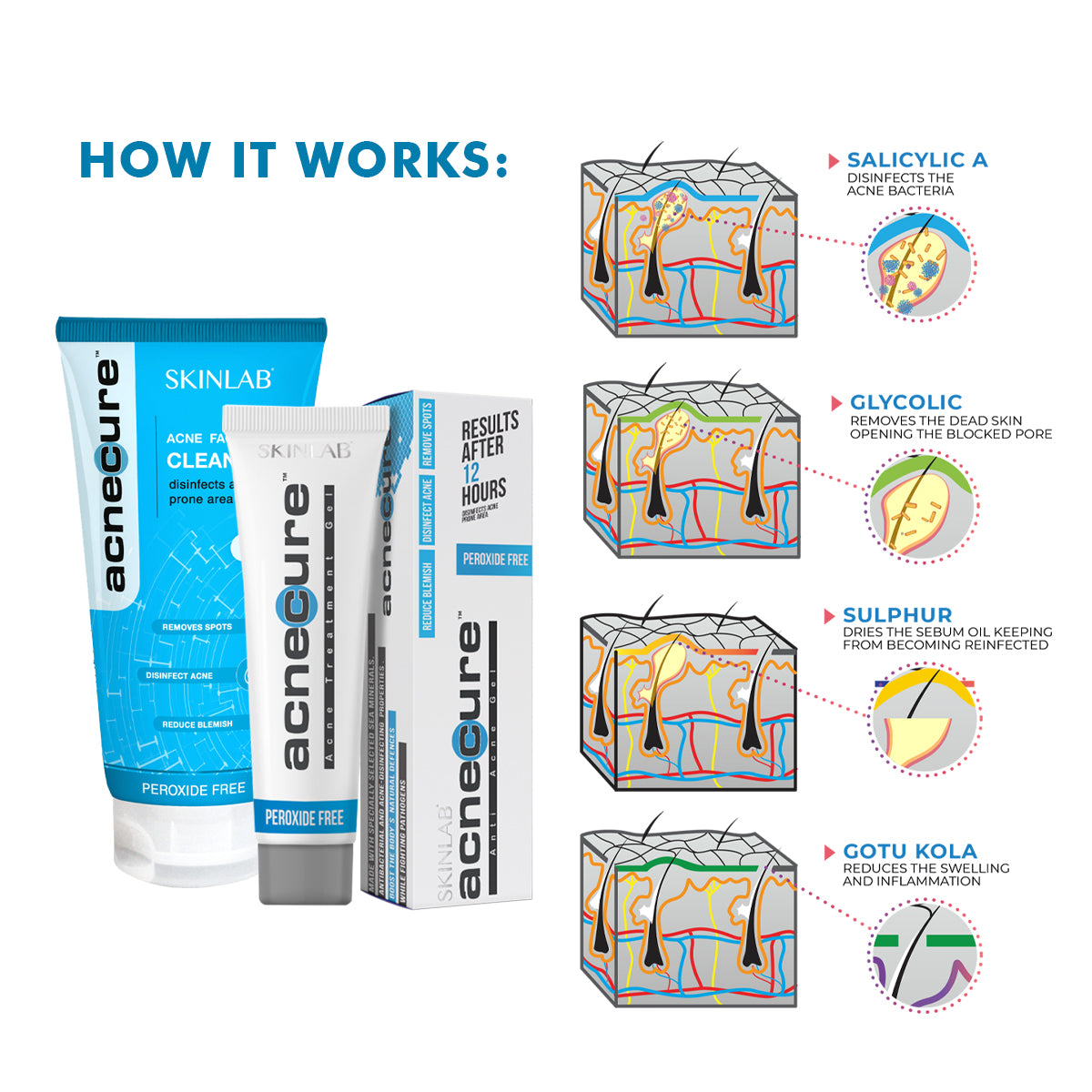 skinlab acnecure how it works